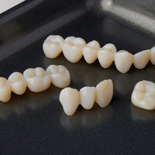 PROVISOIRE résine 3D